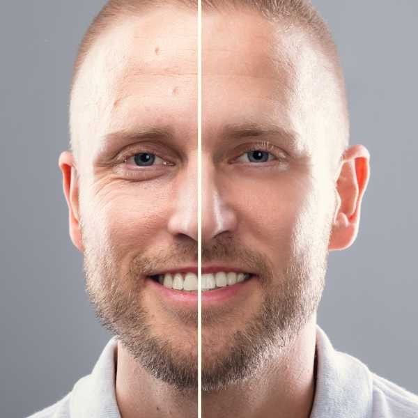 Tratamientos dermatológicos